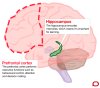 Brain (Image: The Conversation)