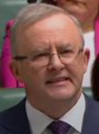 Anthony Albanese